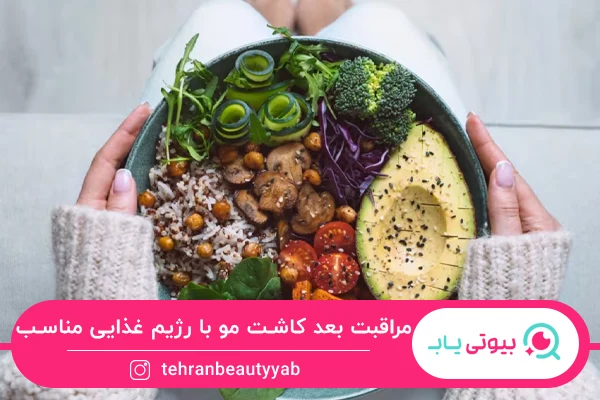 مراقبت بعد از کاشت مو