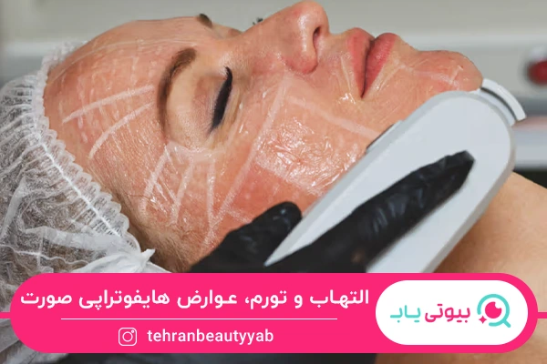 عوارض شایع هایفوتراپی صورت