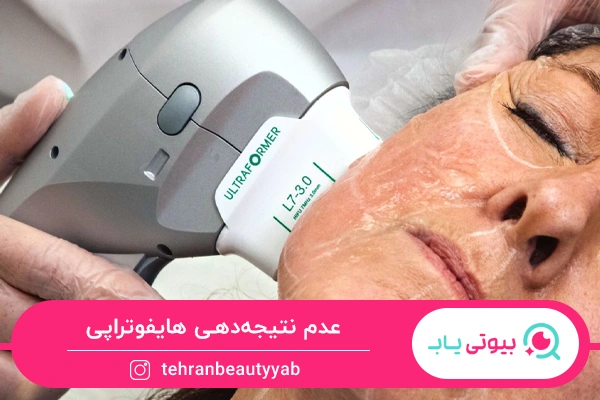 عوارض نادر هایفوتراپی صورت