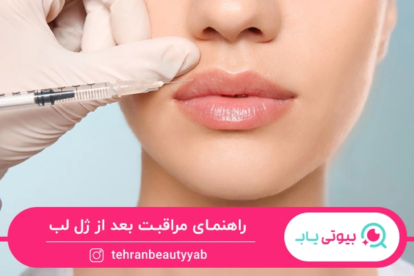 مراقبت بعد از ژل لب