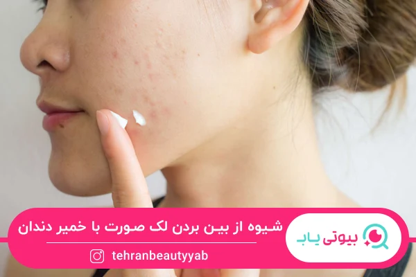 از بین بردن لک صورت با خمیر دندان