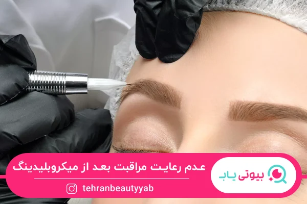 عدم رعایت مراقبت‌ها می‌تواند علت ریزش ابرو بعد از میکروبلیدینگ باشد.