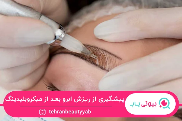 علت ریزش ابرو بعد از میکروبلیدینگ
