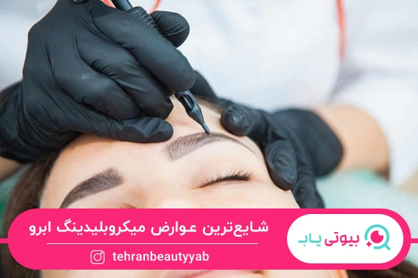 عوارض میکروبلیدینگ ابرو