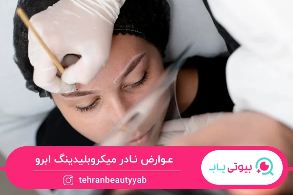 عوارض میکروبلیدینگ ابرو