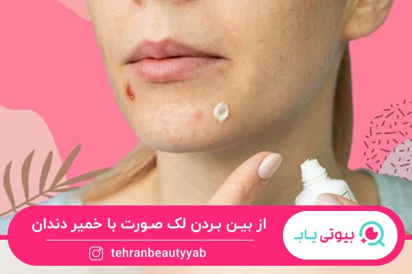 از بین بردن لک صورت با خمیر دندان