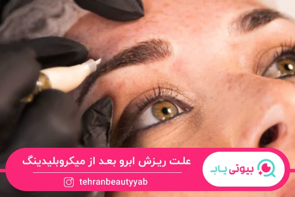 علت ریزش ابرو بعد از میکروبلیدینگ