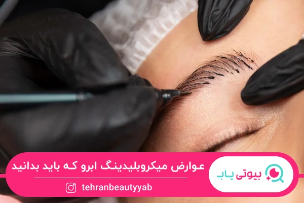 عوارض میکروبلیدینگ ابرو