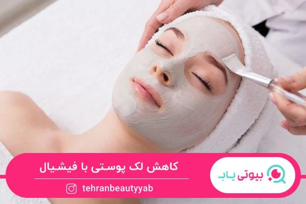 کاهش لک پوستی از مزایای فیشیال صورت است.