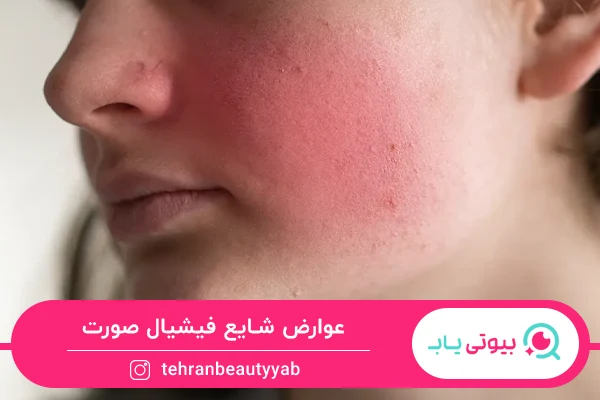 عوارض فیشیال صورت